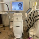 2023 Candela Profound Matrix Microneedling